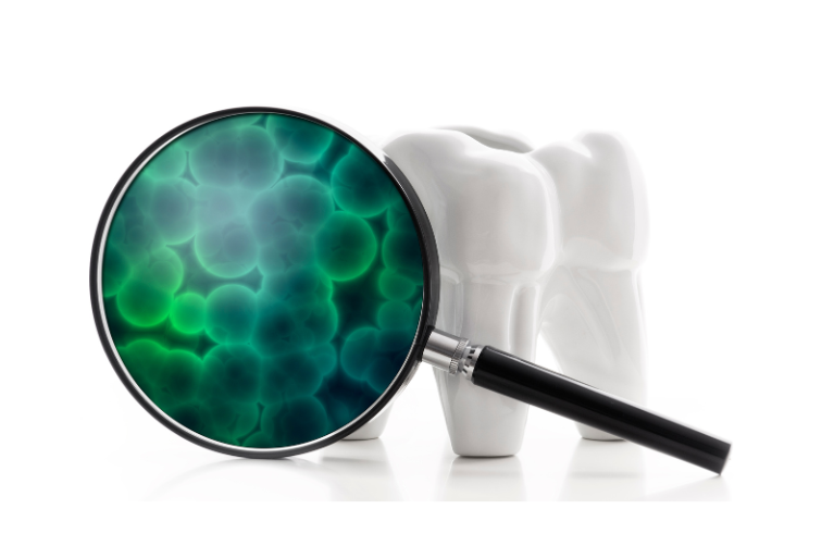 PMTC（プロフェッショナル・メカニカル・トゥース・クリーニング）